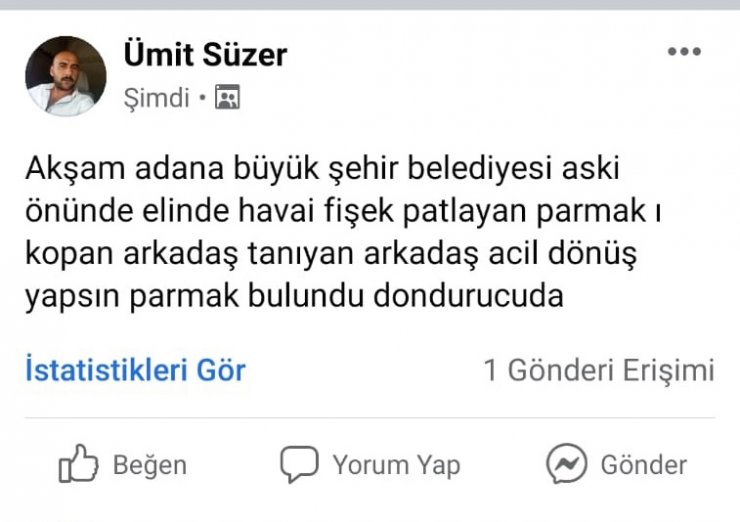 Şampiyonluk Kutlamasında Havai Fişek Elinde Patlayınca Parmakları Parçalandı